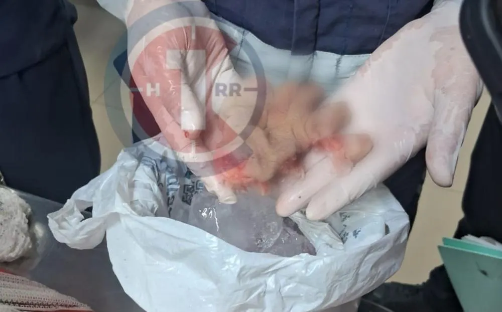 Motociclista Tem Dedos do Pé Amputado Após Colisão