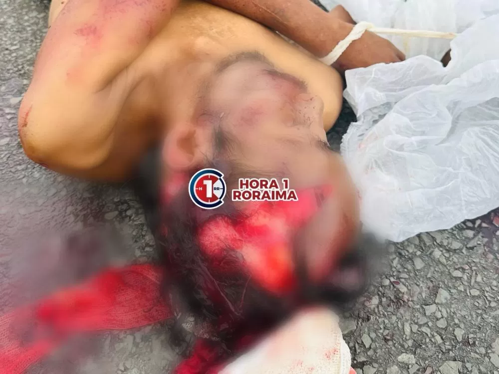 Homem Morre Após Ser Atropelado por Caminhão